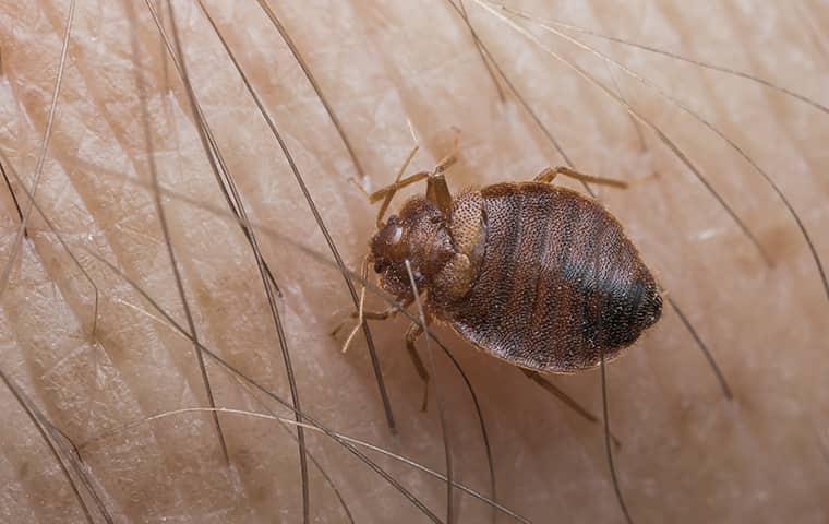 bed-bugs-infestation-biting