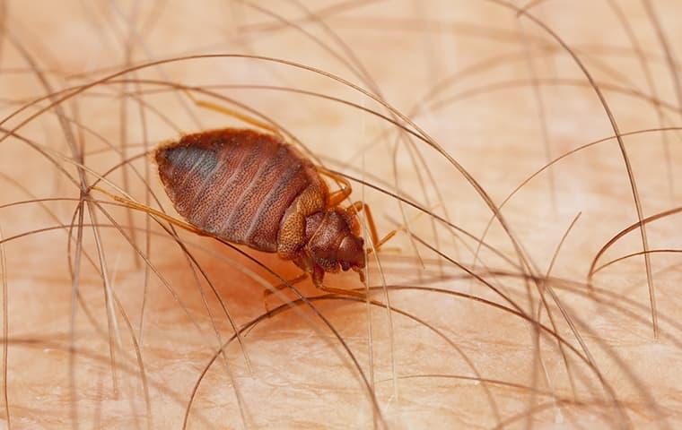 what-to-do-when-bed-bugs-bite